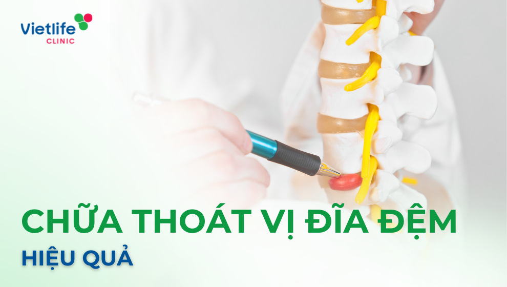 Cách chữa thoát vị đĩa đệm hiệu quả