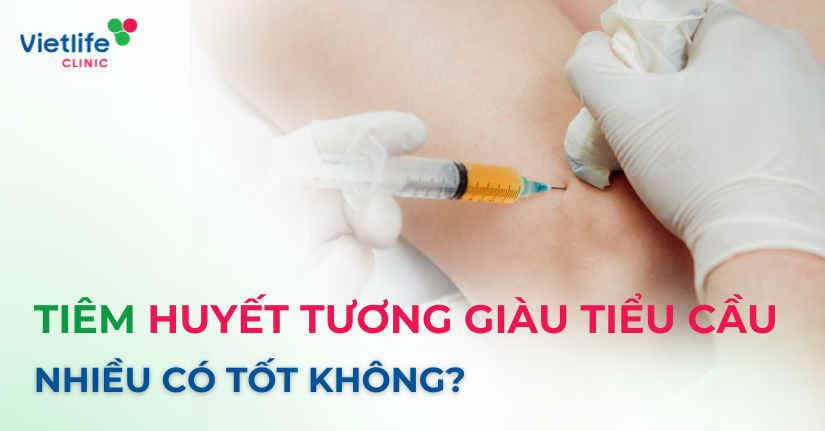 Tiêm huyết tương giàu tiểu cầu