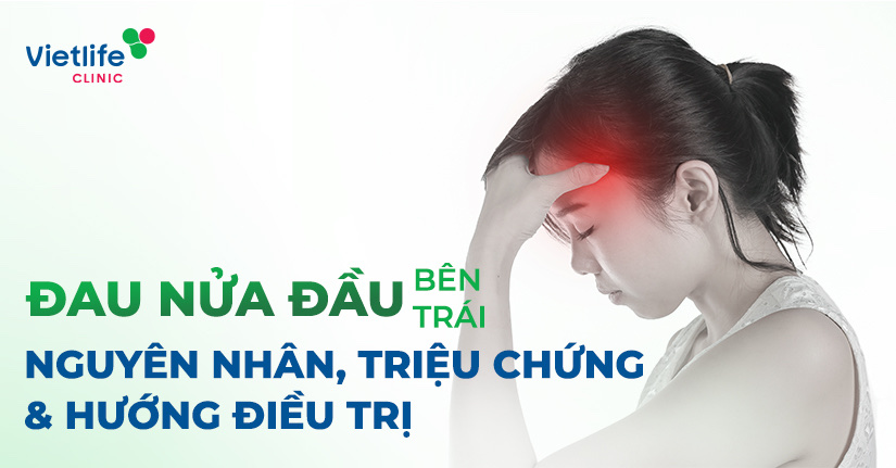 Đau nửa đầu bên trái