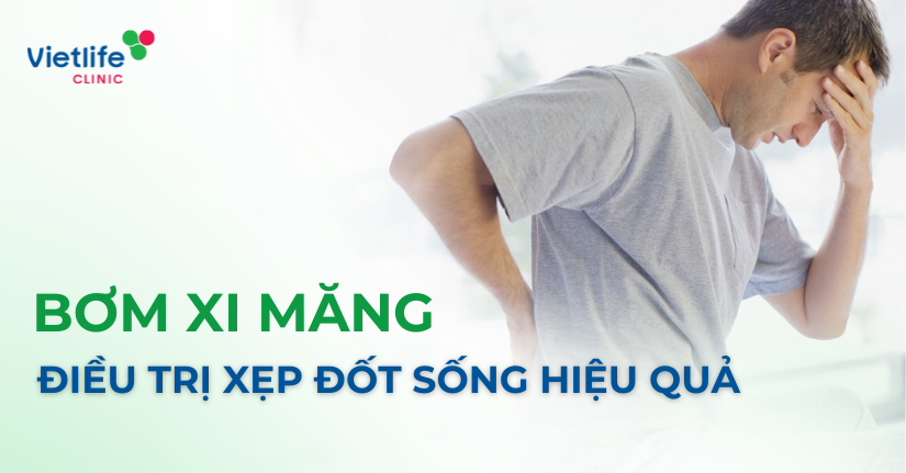 Bơm xi măng cột sống