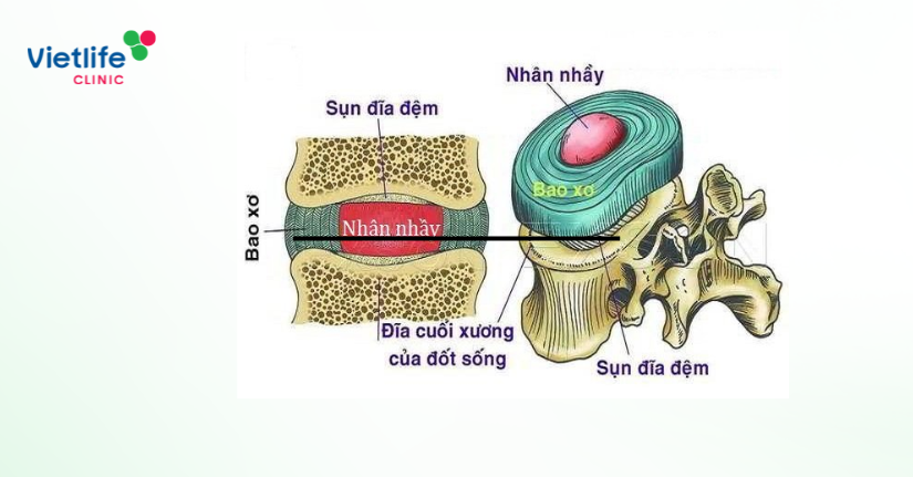  Cấu trúc đĩa đệm