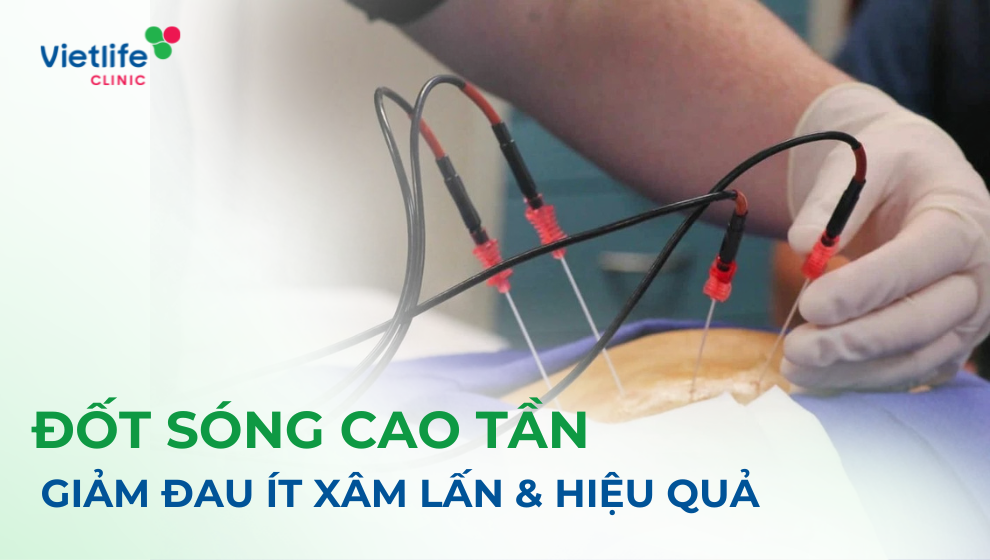 Đốt sóng cao tần