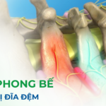 Tiêm phong bế thoát vị đĩa đệm