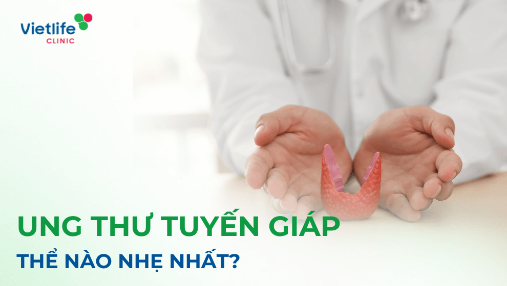 Ung thư tuyến giáp thể nào nhẹ nhất?