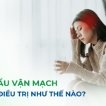 Đau đầu vận mạch