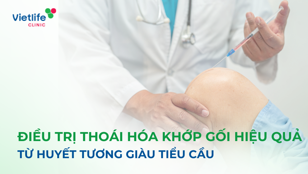 điều trị thoái hóa khớp gối
