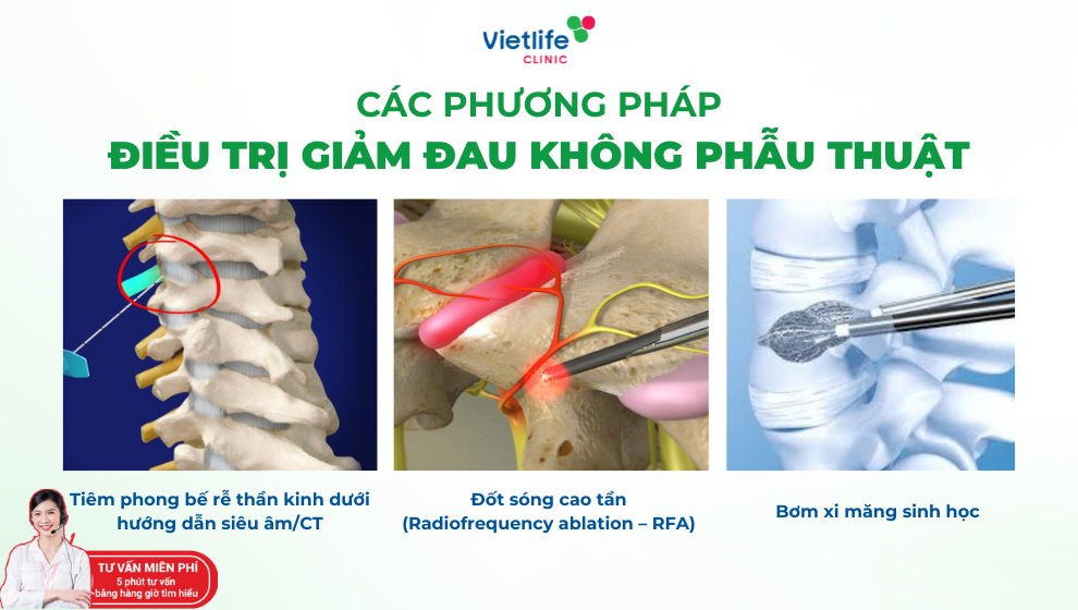 đăng ký tư vấn Vietlife