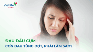 Đau đầu cụm