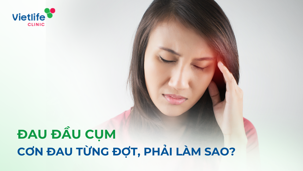 Đau đầu cụm