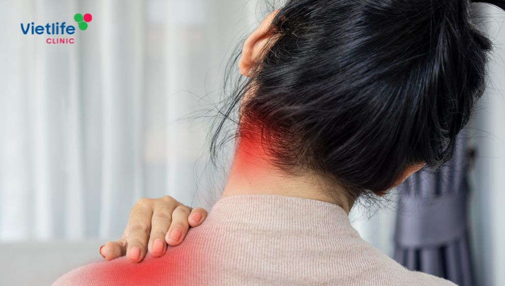 Đau nửa đầu sau bên trái