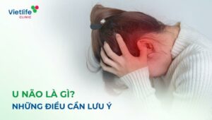 U não là gì